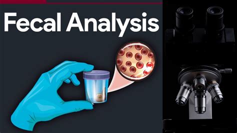 fecalysis test|Step.